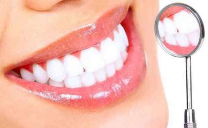 Diş beyazlatma uygulaması ile dişler nasıl beyazlıyor?