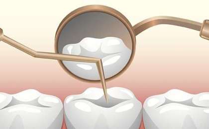 Diş Çürüğü Ve Tedavisi Nasıl Yapılabilir?