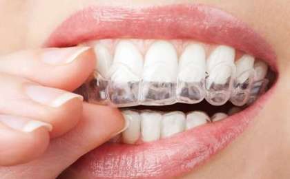 Diş Sıkması Neden Oluşur?