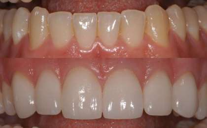 Diş Tedavilerinde Hasta Bilgilendirilmesi