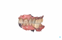 İnley Dolgu Yapımı