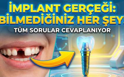 İmplant Yaptıranlar İçin Beslenme Önerileri 