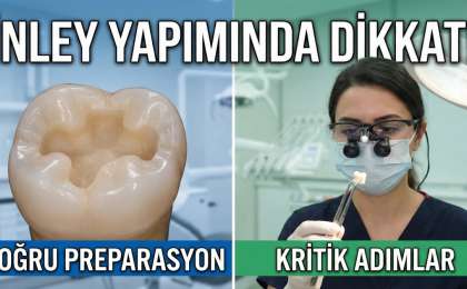 İnley ve Onley Diş Dolgusu 