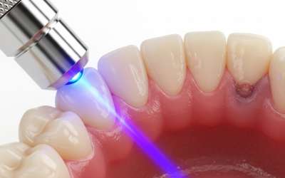 Lazer Terapisinin kemik onarımı üzerindeki etkileri 