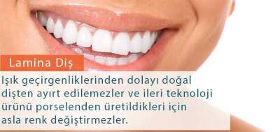 Empress Diş Nedir?