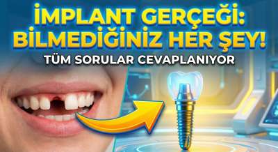 İmplant Yaptıranlar İçin Beslenme Önerileri