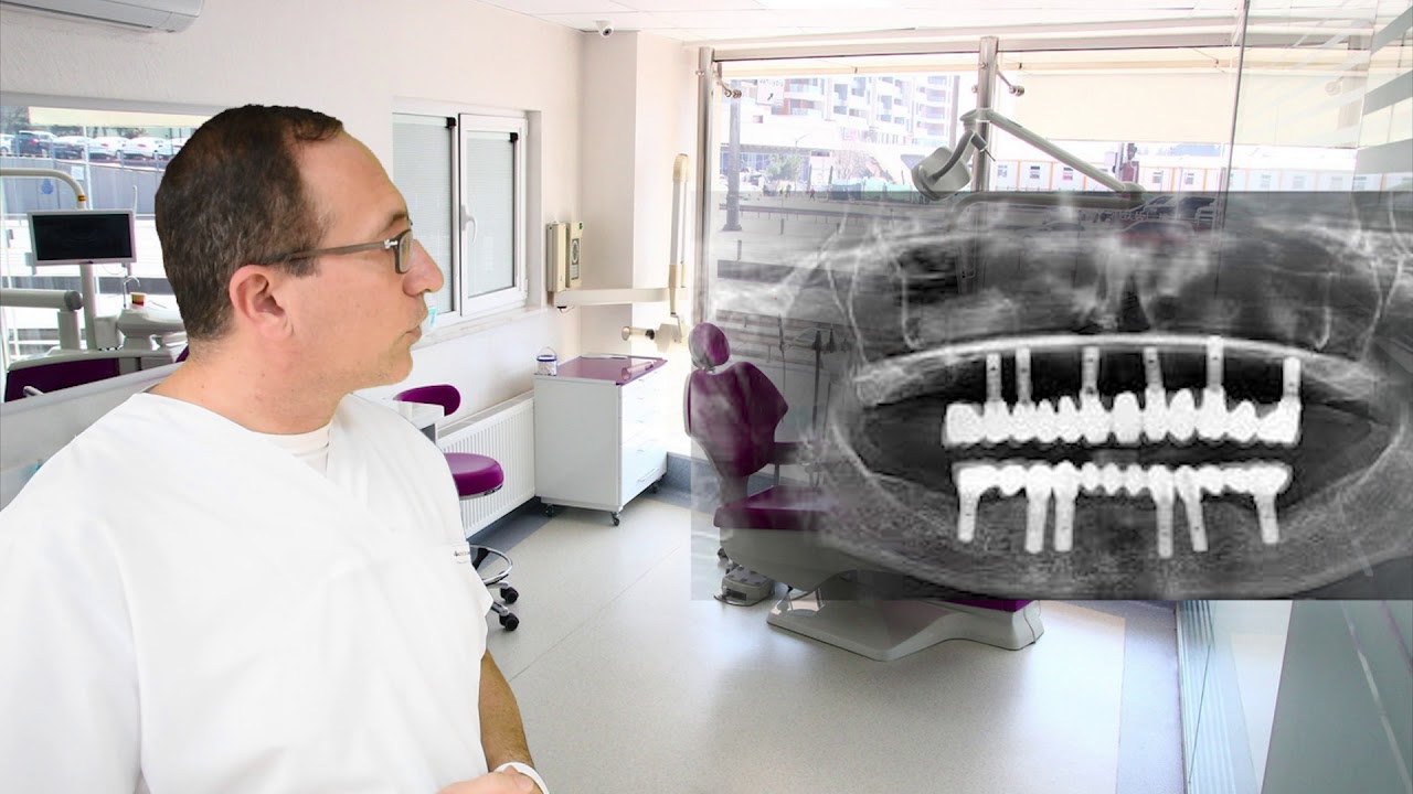 Benim dişime kaç implant yapılır? Kaç implant gerekir? İmplant fiyatını aşağıya yazdım. Okuyunuz.