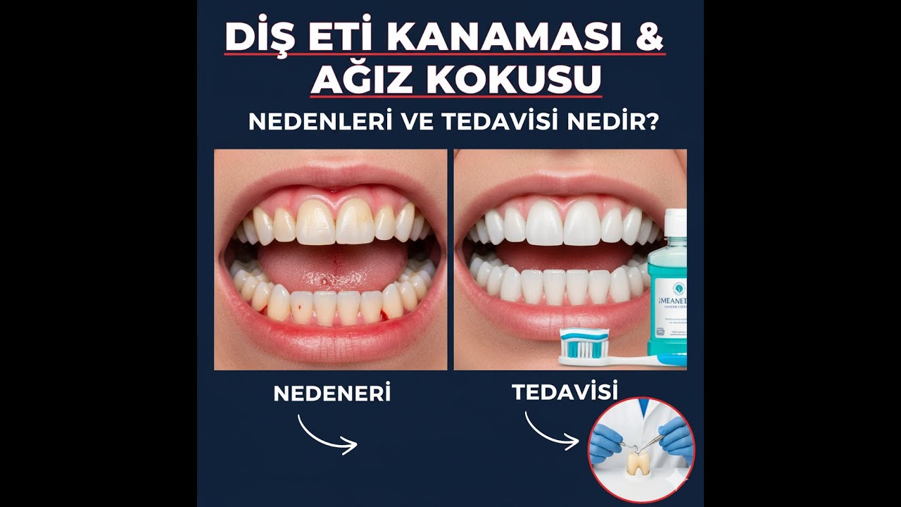 Diş eti kanaması ağız kokusu tedavisi. Zirkonyum diş kaplama ve koruyucu tedaviler.